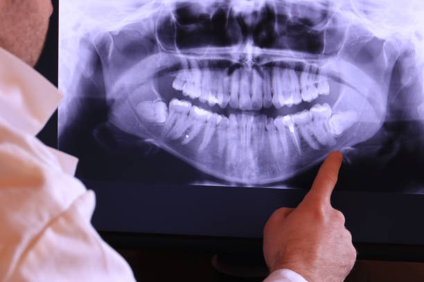 Best Emergency Dental Surgery in Pantego, TX